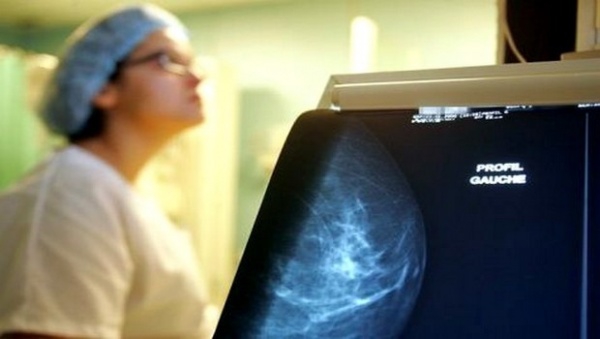 Découverte de la presque la totalité des anomalies génétiques à l’origine des cancers du sein